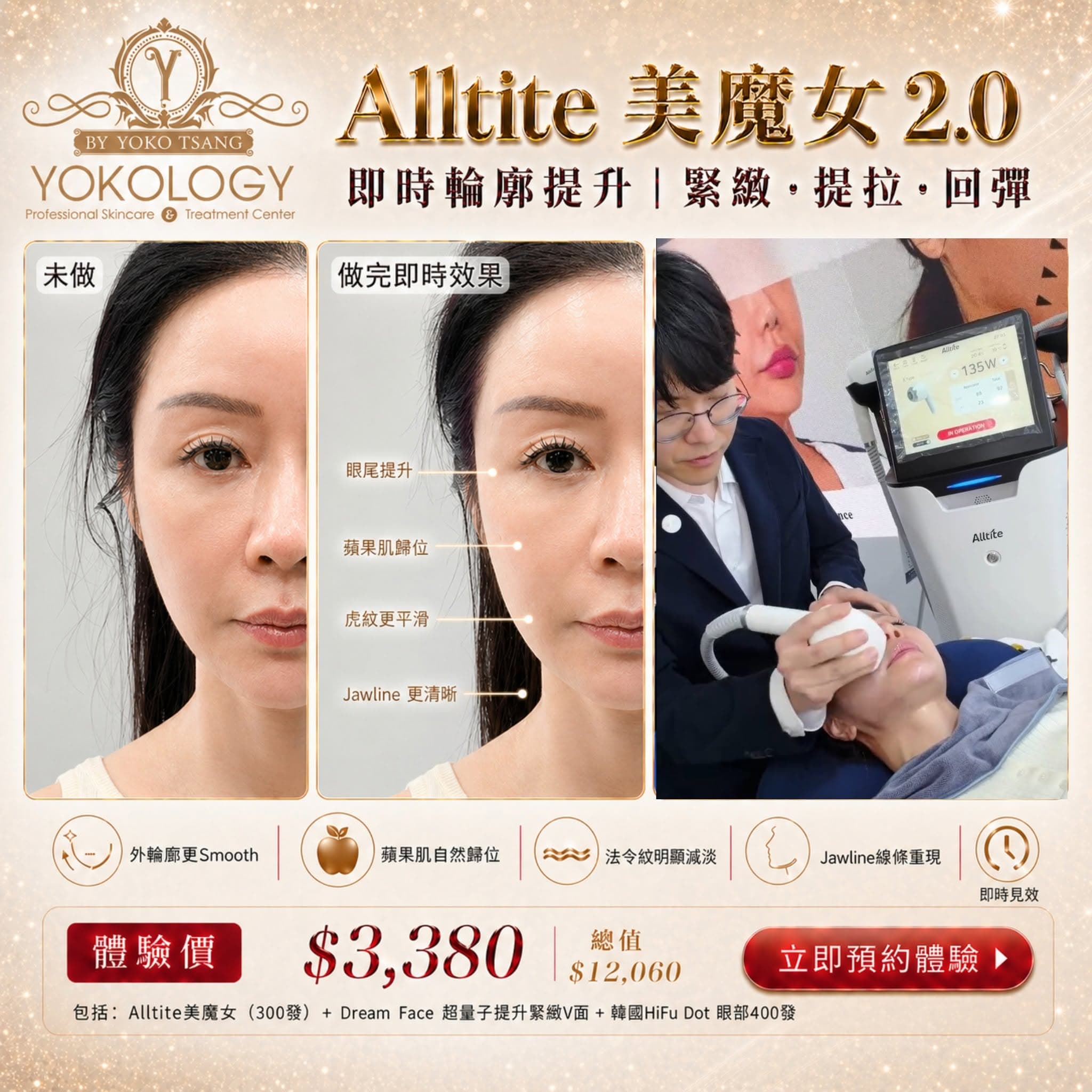 Alltite 美魔女 真實案例 1 / 2